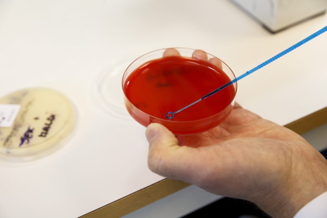 Antibiotikaanvändning pekas ut som en riskfaktor för inflammatorisk tarmsjukdom, enligt en ny studie vid Karolinska institutet.