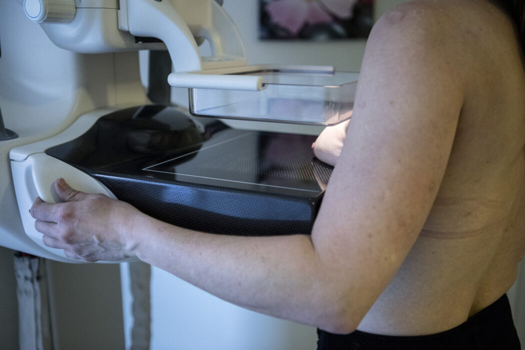 Mammografi ökar chansen att brösttumörer upptäcks i tidigt skede, men hur stor andel av kvinnorna som deltar skiljer sig stort i landet.