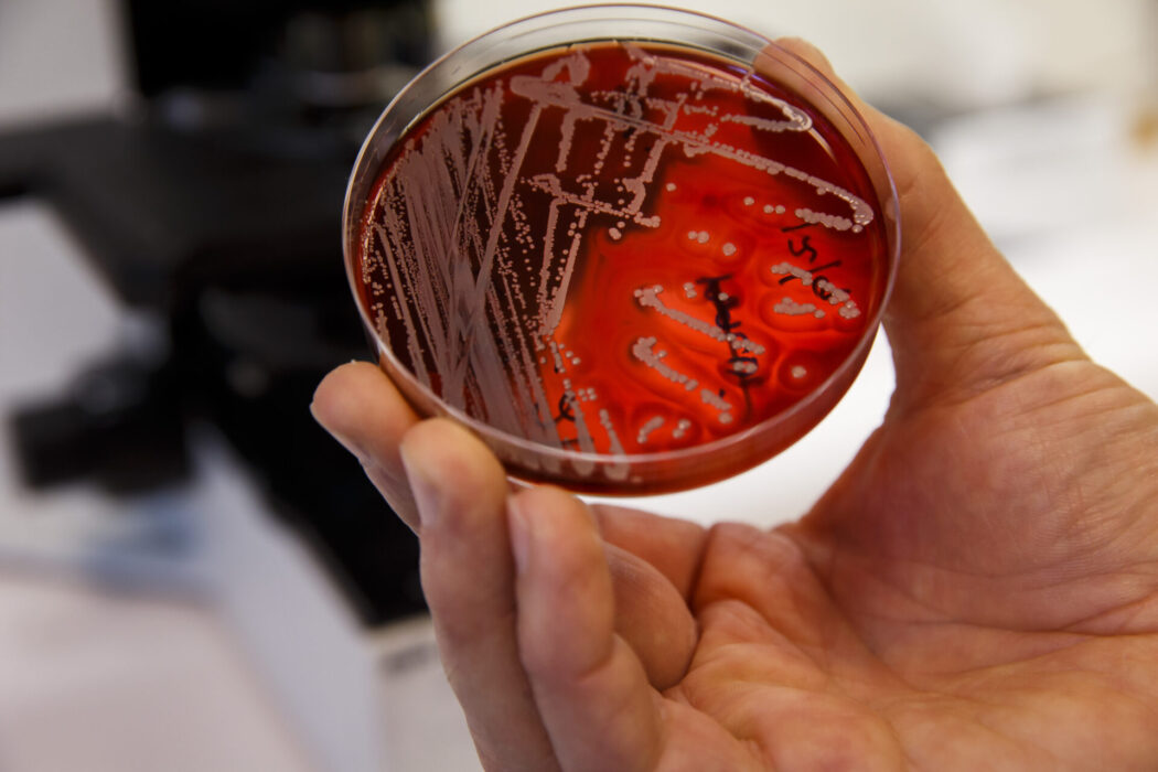 Antibiotikaresistens klassas av Världshälsoorganisationen (WHO) som ett av de största hälsohoten som mänskligheten.